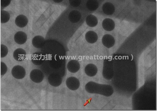 BGA因?yàn)楹笁|變小，造成錫膏過(guò)多而最終形成焊接短路的結(jié)果。